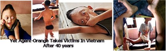 agent-orange_victims.jpg